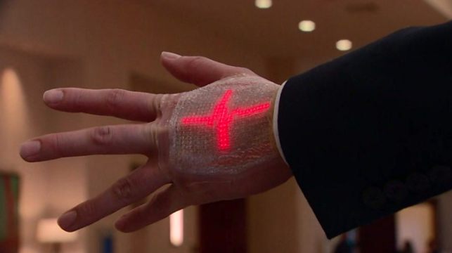Wearable tech helps stroke patients